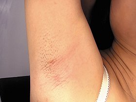 BBM女体図鑑 腋 脇 わき　サンプル画像07